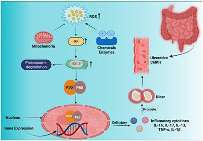 Recent updates on correlation between reactive oxygen species and synbiotics for effective management of ulcerative colitis
